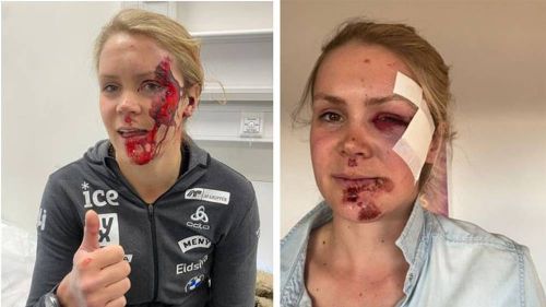 Bad bike accident for Karoline Knotten